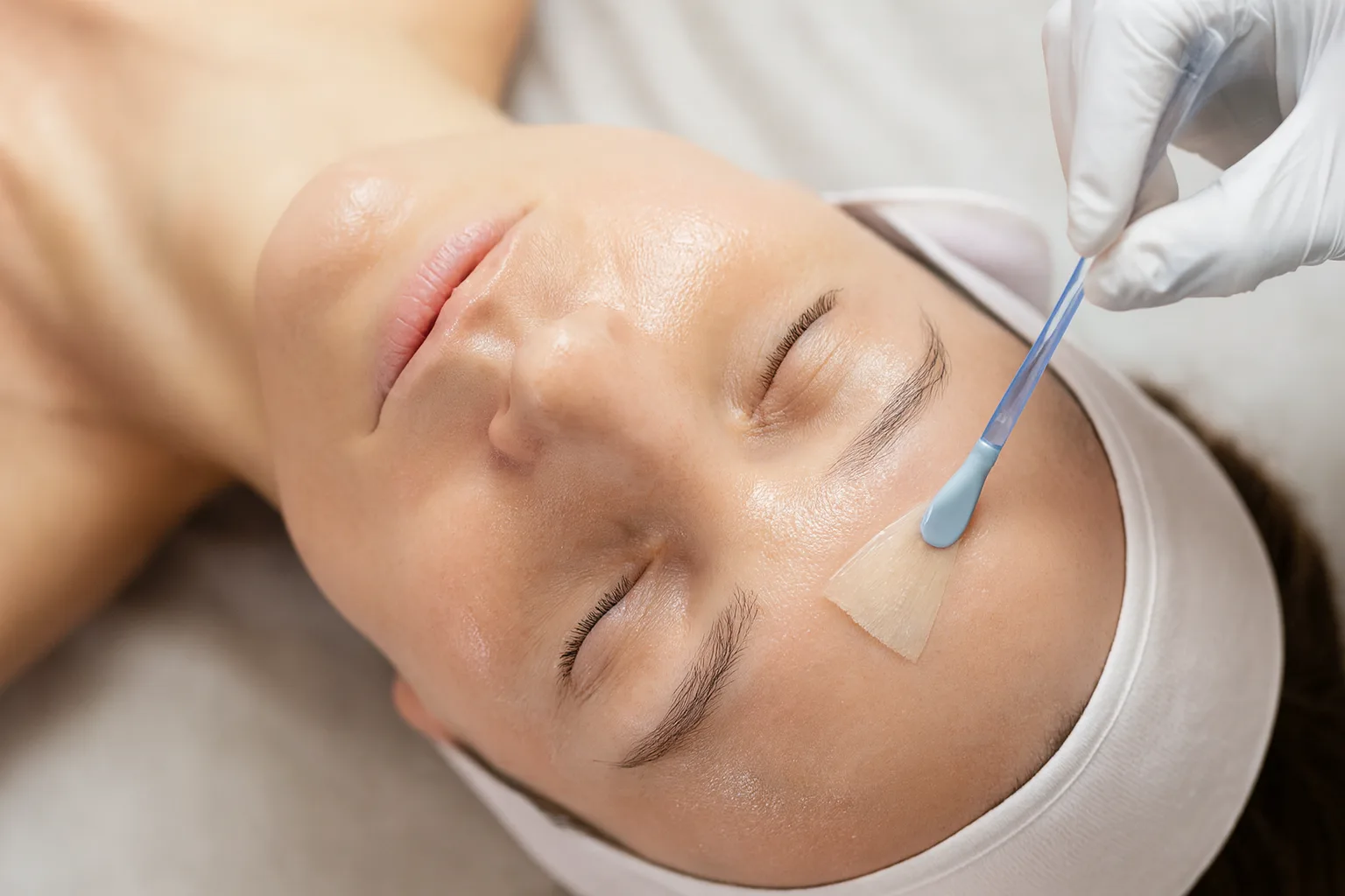 Peeling chimique Marrakech