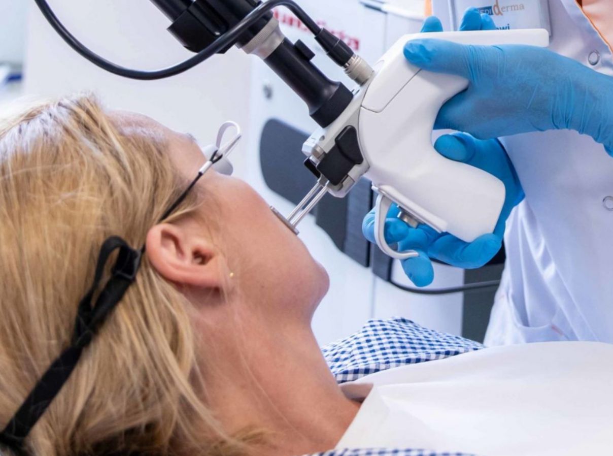 Laser dermatologie Marrakech — mélasma taches